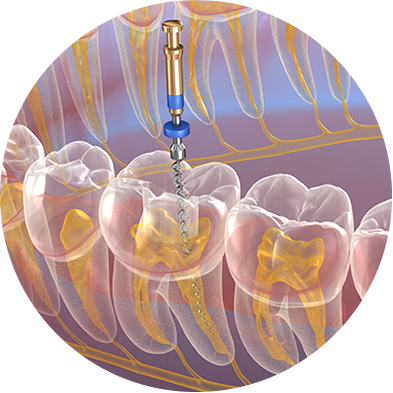 Endodontics Training