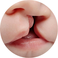 Maxillofacial Anomalies