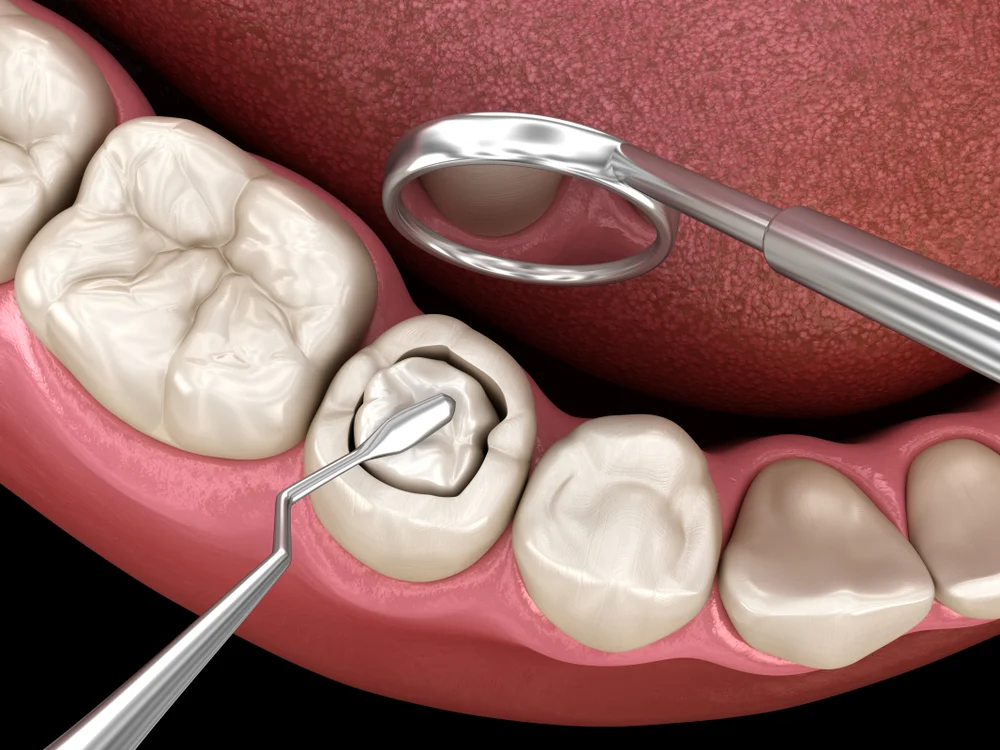 Periodontal Plastic Surgery: Clinical Solutions for Common Patient Concerns