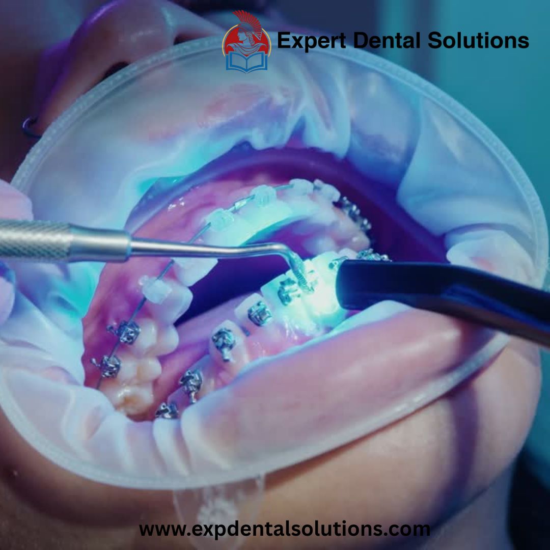 Comprehensive Dental Implant Training in Brazil: From Basic to Advanced for U.S. Dentists